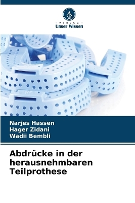 Abdrücke in der herausnehmbaren Teilprothese