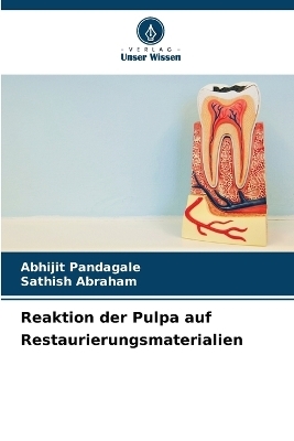 Reaktion der Pulpa auf Restaurierungsmaterialien - ABHIJIT PANDAGALE, SATHISH ABRAHAM