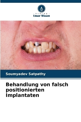 Behandlung von falsch positionierten Implantaten