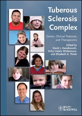 Tuberous Sclerosis Complex &ndash; Genes, Clinical Features and Therapeutics - DJ Kwiatkowski