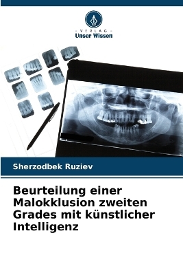 Beurteilung einer Malokklusion zweiten Grades mit künstlicher Intelligenz