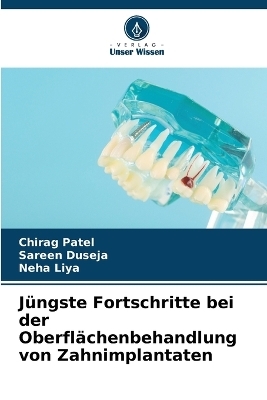 J&uuml;ngste Fortschritte bei der Oberfl&auml;chenbehandlung von Zahnimplantaten - Chirag Patel, Sareen Duseja, Neha Liya