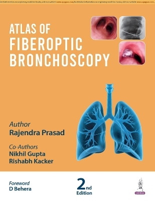 Atlas of Fiberoptic Bronchoscopy - Rajendra Prasad