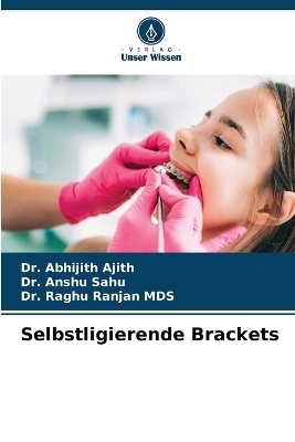 Selbstligierende Brackets