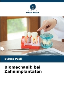 Biomechanik bei Zahnimplantaten - Sujeet Patil