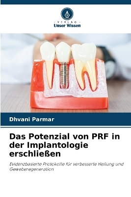 Das Potenzial von PRF in der Implantologie erschlie&szlig;en - Dhvani Parmar