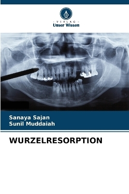 Wurzelresorption - Sanaya Sajan, Sunil Muddaiah