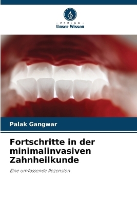 Fortschritte in der minimalinvasiven Zahnheilkunde - Palak Gangwar