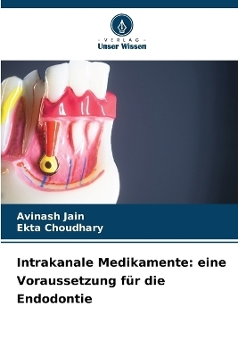 Intrakanale Medikamente