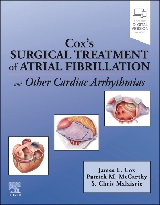 Cox's Surgical Treatment of Atrial Fibrillation - James Cox, S. Chris Malaisrie, Patrick M. McCarthy