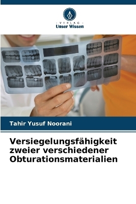 Versiegelungsf&auml;higkeit zweier verschiedener Obturationsmaterialien - Tahir Yusuf Noorani