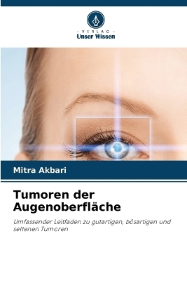Tumoren der Augenoberfläche