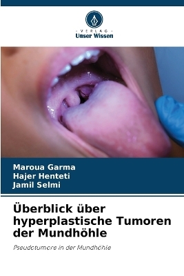 &Uuml;berblick &uuml;ber hyperplastische Tumoren der Mundh&ouml;hle - Maroua Garma, Hajer Henteti, Jamil Selmi