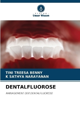 Dentalfluorose - Tini Treesa Benny, K Sathya Narayanan