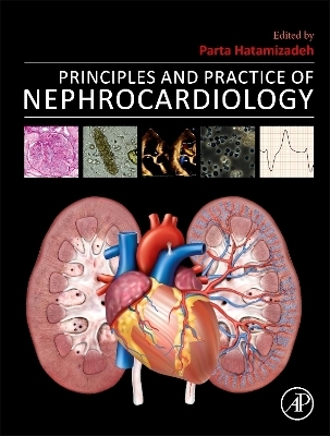 Principles and Practice of Nephrocardiology - 