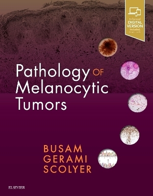 Pathology of Melanocytic Tumors - Klaus J. Busam, Pedram Gerami, Richard A Scolyer