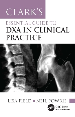 Clark's Essential Guide to DXA in Clinical Practice