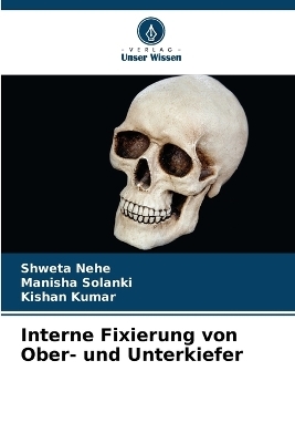Interne Fixierung von Ober- und Unterkiefer