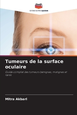 Tumeurs de la surface oculaire - Mitra Akbari