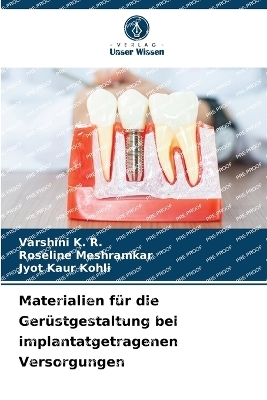 Materialien f&uuml;r die Ger&uuml;stgestaltung bei implantatgetragenen Versorgungen - Varshini K R, ROSELINE MESHRAMKAR, Jyot Kaur Kohli