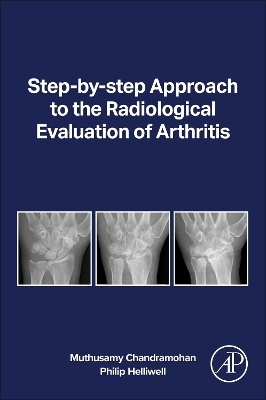 Step-by-step Approach to the Radiological Evaluation of Arthritis - Muthusamy Chandramohan, Philip Helliwell