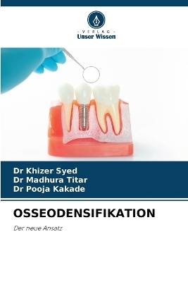Osseodensifikation - Dr Khizer Syed, Dr Madhura Titar, Dr Pooja Kakade