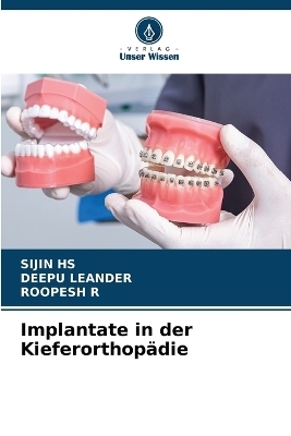 Implantate in der Kieferorthop&auml;die - SIJIN HS, DEEPU LEANDER, ROOPESH R