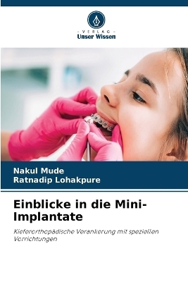 Einblicke in die Mini-Implantate - Nakul Mude, Ratnadip Lohakpure