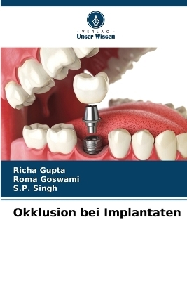 Okklusion bei Implantaten - Richa Gupta, Roma Goswami, S P Singh