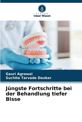 J&uuml;ngste Fortschritte bei der Behandlung tiefer Bisse - Gauri Agrawal, Suchita Tarvade Daokar