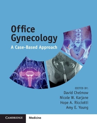 Office Gynecology - 