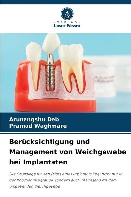 Ber&uuml;cksichtigung und Management von Weichgewebe bei Implantaten - Arunangshu Deb, Pramod Waghmare