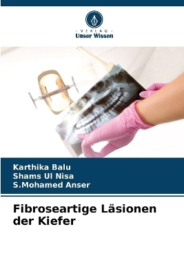 Fibroseartige L&auml;sionen der Kiefer - Karthika Balu, Shams Ul Nisa, S.Mohamed Anser