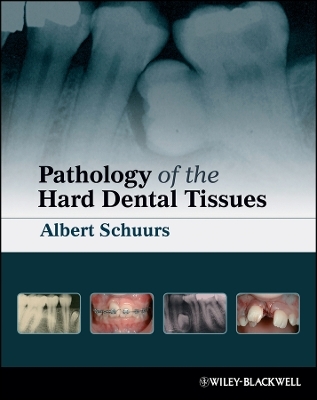Pathology of the Hard Dental Tissues - AB Schuurs