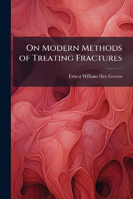 On Modern Methods of Treating Fractures - Ernest William Hey Groves