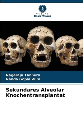 Sekund&auml;res Alveolar Knochentransplantat - Nagaraju Tanneru, Nanda Gopal Vura