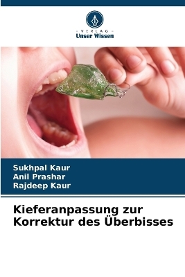 Kieferanpassung zur Korrektur des &Uuml;berbisses - Sukhpal Kaur, Anil Prashar, Rajdeep Kaur