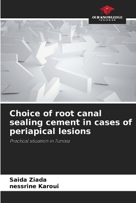 Choice of root canal sealing cement in cases of periapical lesions