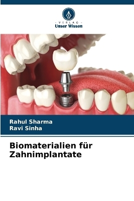 Biomaterialien f&uuml;r Zahnimplantate - Rahul Sharma, Ravi Sinha