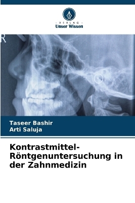 Kontrastmittel-Röntgenuntersuchung in der Zahnmedizin