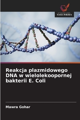 Reakcja plazmidowego DNA w wielolekoopornej bakterii E. Coli