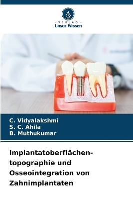 Implantatoberfl&auml;chen- topographie und Osseointegration von Zahnimplantaten - C Vidyalakshmi, S C Ahila, B Muthukumar