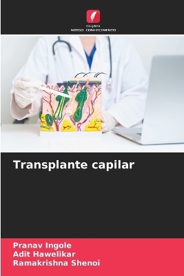 Transplante capilar