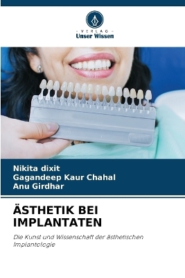 &Auml;sthetik Bei Implantaten - Nikita Dixit, Gagandeep kaur Chahal, ANU Girdhar