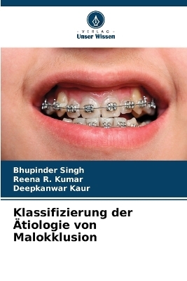 Klassifizierung der &Auml;tiologie von Malokklusion - Bhupinder Singh, Reena R Kumar, Deepkanwar Kaur