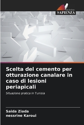 Scelta del cemento per otturazione canalare in caso di lesioni periapicali