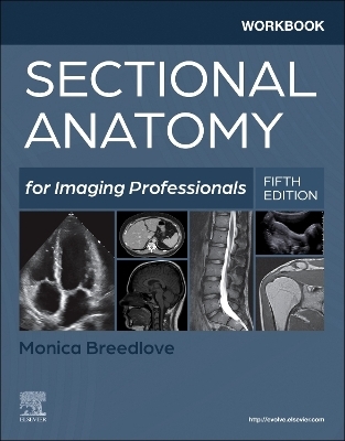 Workbook for Sectional Anatomy for Imaging Professionals - Monica Breedlove