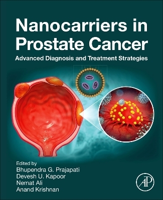 Nanocarriers in Prostate Cancer - 
