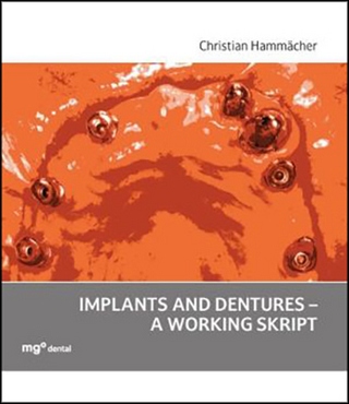 Implants and dentures - a working skript
