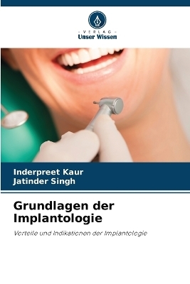 Grundlagen der Implantologie - Inderpreet Kaur, Jatinder Singh